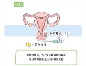 上海集爱医院供卵时间，供卵怀孕出现意外